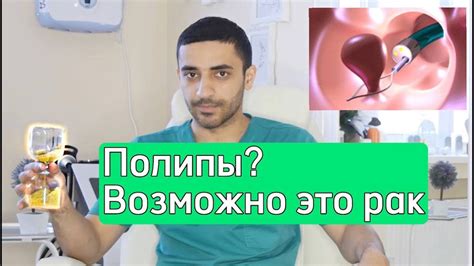  Симптомы и диагностика узлов в прямой кишке